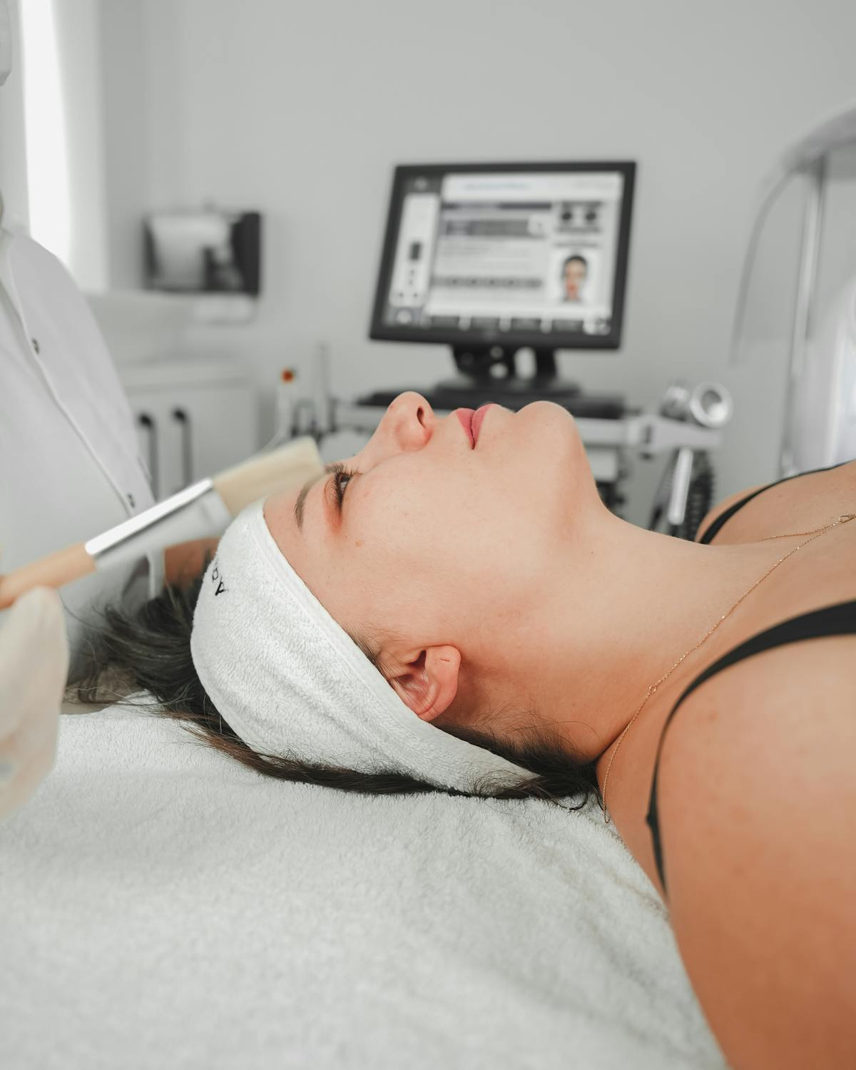 Chemical Peels in New Braunfels: Which Type Is Best for Your Skin?
