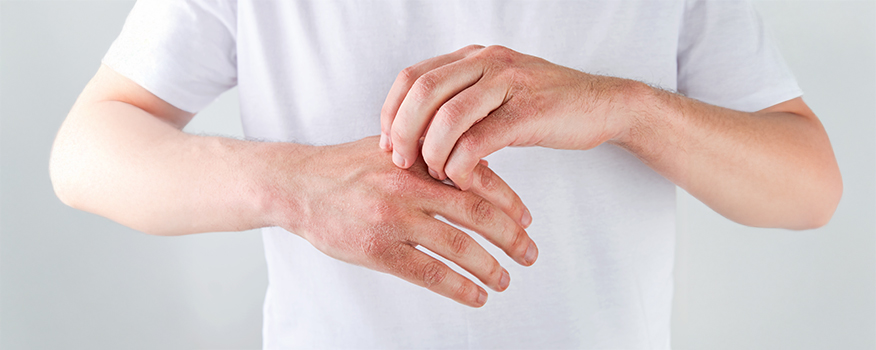 Eczema vs. Psoriasis: What are the Differences and How to Treat Both