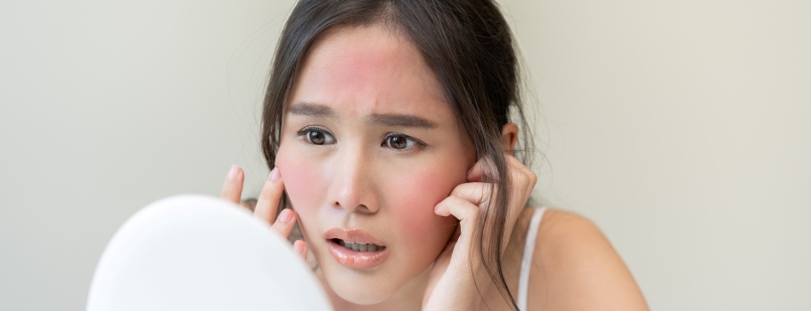 Why Is My Face Always Red? Common Causes Beyond Rosacea