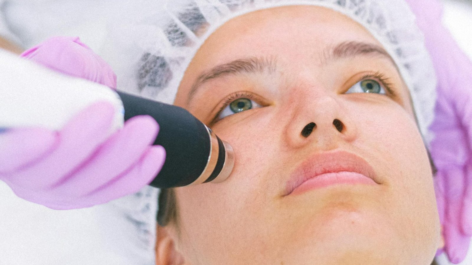 RF Microneedling in New Braunfels: The Collagen-Building Treatment That Tightens, Smooths, and Resurfaces Skin