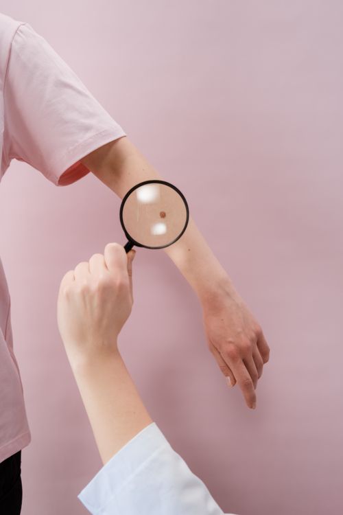 Basal Cell Carcinoma: The Most Common Skin Cancer in Texas
