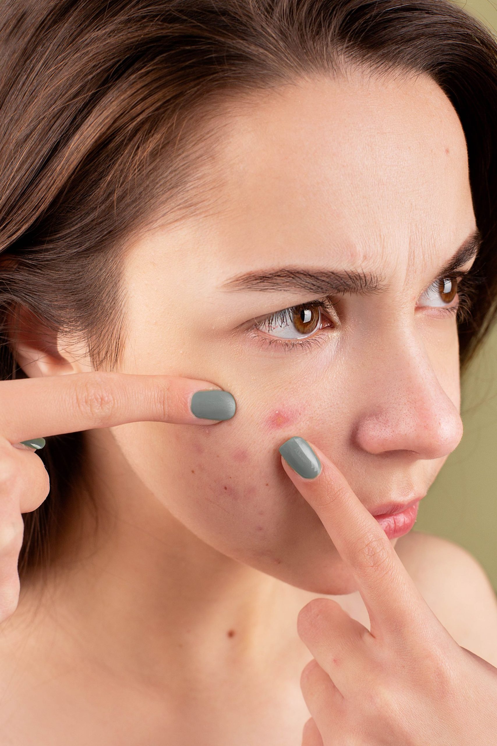 Teen Acne Treatment in New Braunfels, TX: A Parent’s Complete Guide
