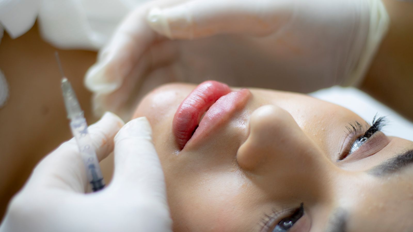 Lip Augmentation in New Braunfels, TX: What to Expect from Filler Treatment