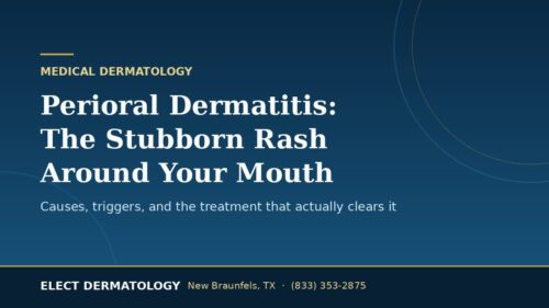 Perioral Dermatitis: The Stubborn Rash Around Your Mouth