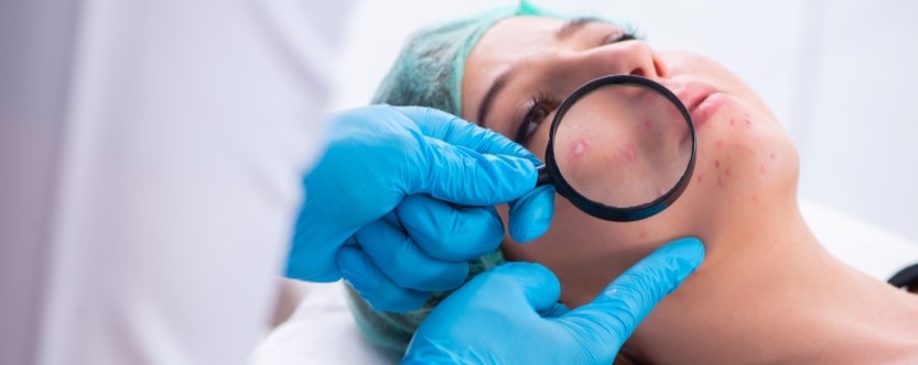 How to Treat Rosacea: Tips From a Dermatologist in New Braunfels