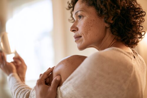 How to Do a Self Skin Exam at Home: A Dermatologist’s Guide