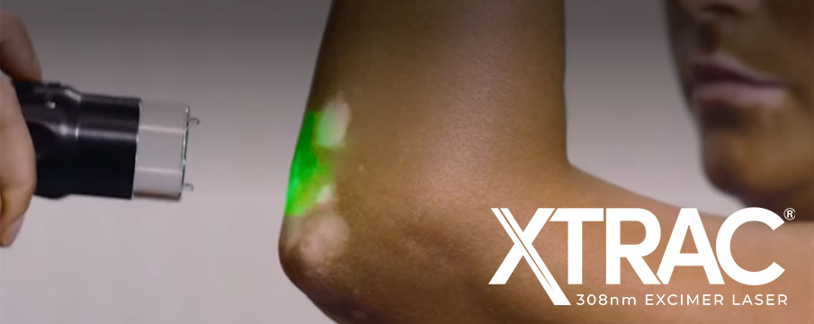 XTRAC laser treatment in New Braunfels TX for psoriasis vitiligo and eczema